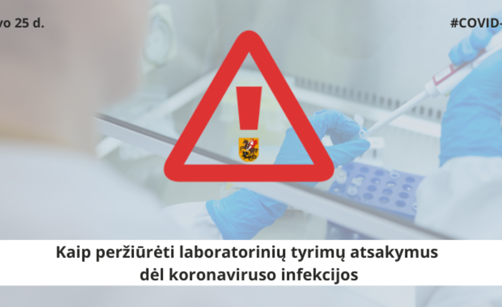 Laboratorinių tyrimų atsakymus dėl koronaviruso infekcijos peržiūrėkite internete